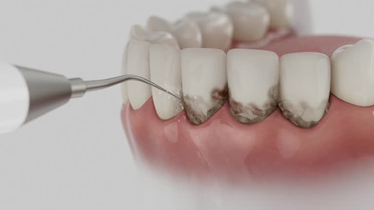 Trusted Root Canal Treatment service in Cape Girardeau, MO - Dentist Open Now